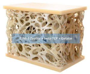 ZSM-5 Zeolite/bTCP/Gelatin Composite Scaffold for Bone Regeneration